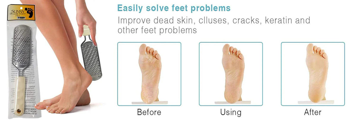 SUNNY REPLACEMENT SUPER FOOT FILE